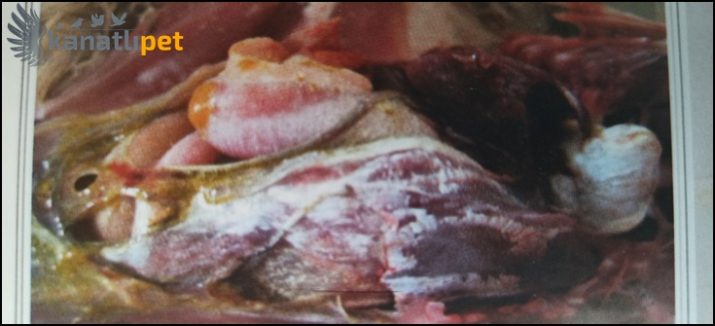 Gut Hastalığının Başlıca Sebepleri